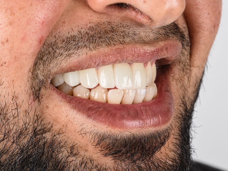 اختبار — بعد